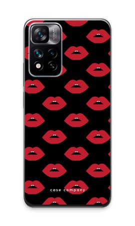 Lips