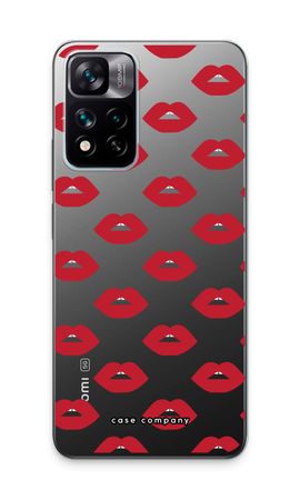 Lips