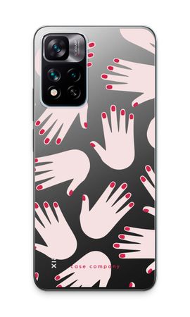 Hands pink