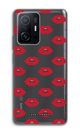 Lips