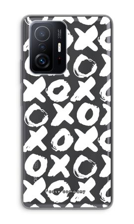 XOXO