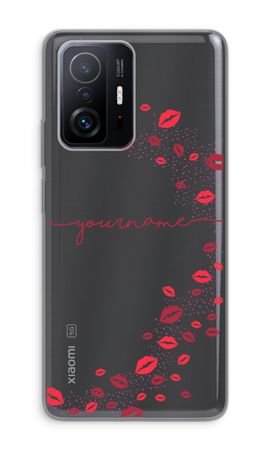 Kisses