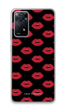 Lips