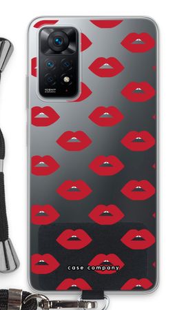 Lips
