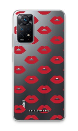 Lips