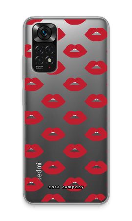 Lips
