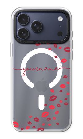 Kisses