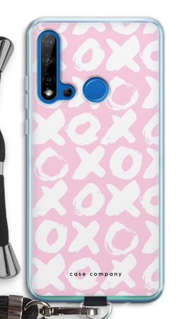 XOXO