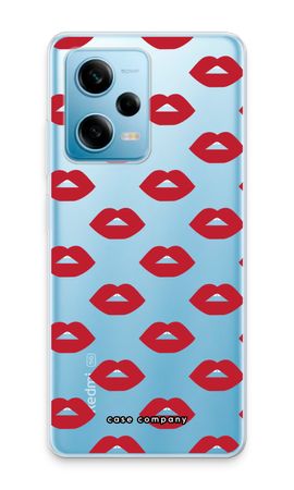 Lips