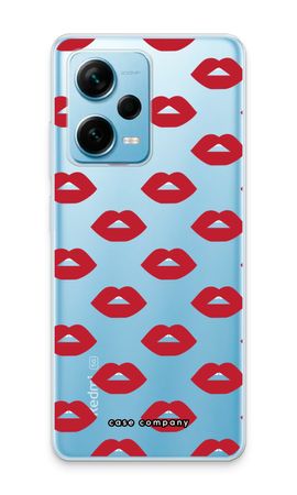 Lips