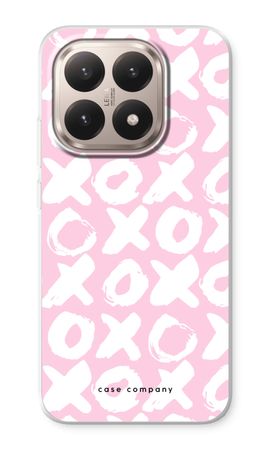 XOXO