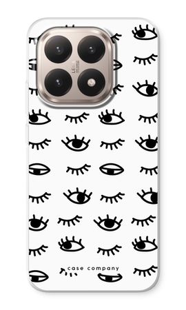 Eye pattern #2