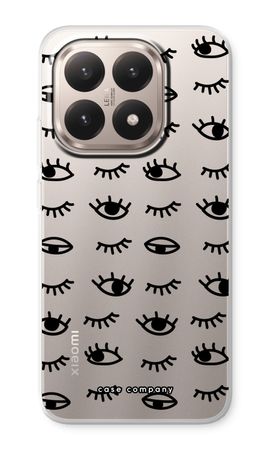 Eye pattern #2