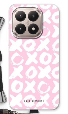 XOXO