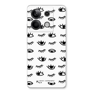 Eye pattern #2