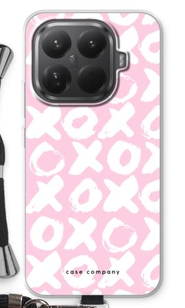 XOXO