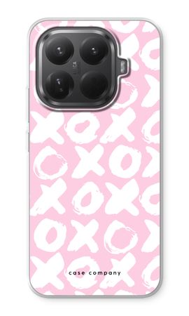 XOXO