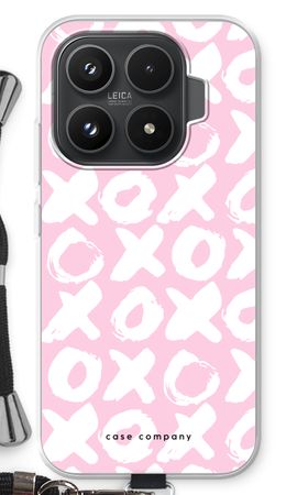XOXO