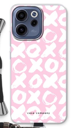 XOXO
