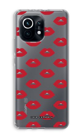 Lips