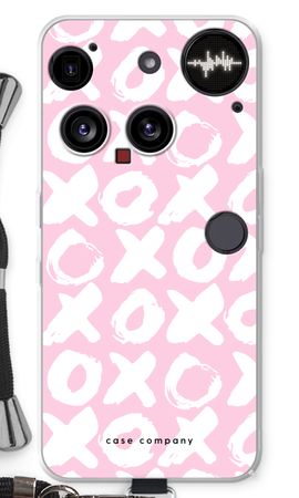 XOXO
