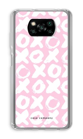 XOXO
