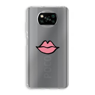 Labios