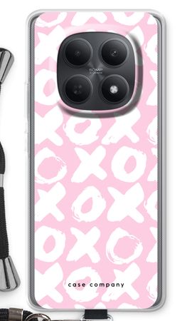 XOXO