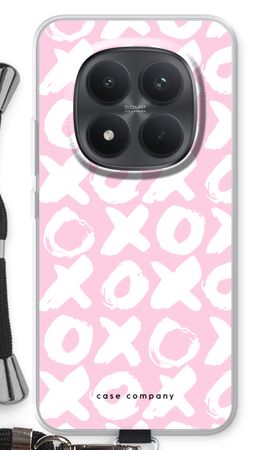 XOXO