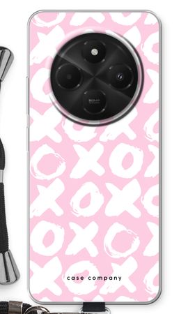 XOXO