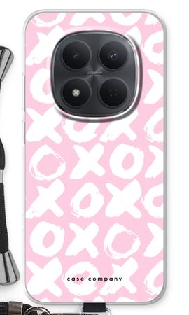 XOXO