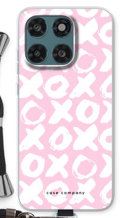 XOXO
