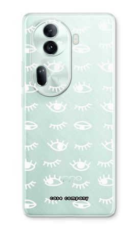 Eye pattern #3