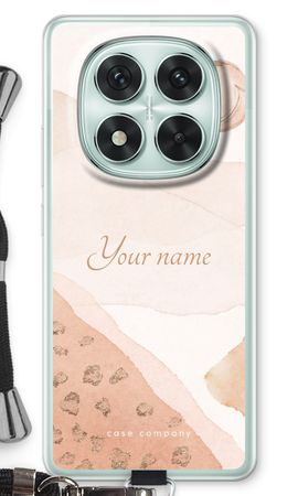 Gold Spots Namecase - Blush
