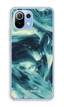 Dreaming About Whales