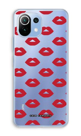 Lips