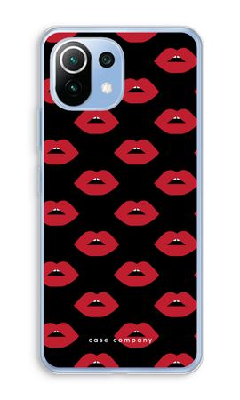 Lips