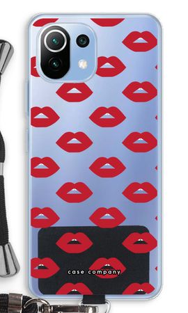 Lips