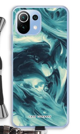 Dreaming About Whales