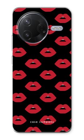 Lips