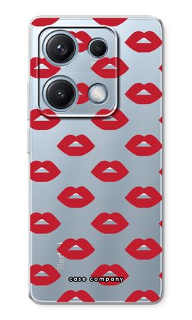Lips