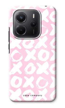 XOXO