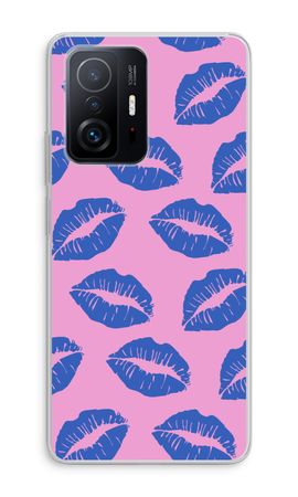 Lips