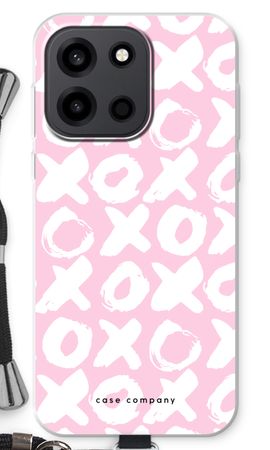 XOXO