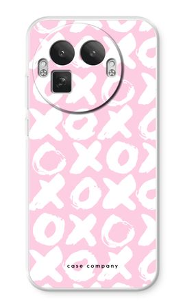 XOXO