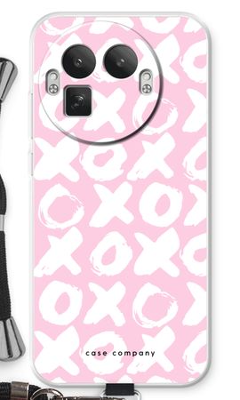 XOXO
