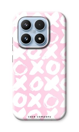 XOXO